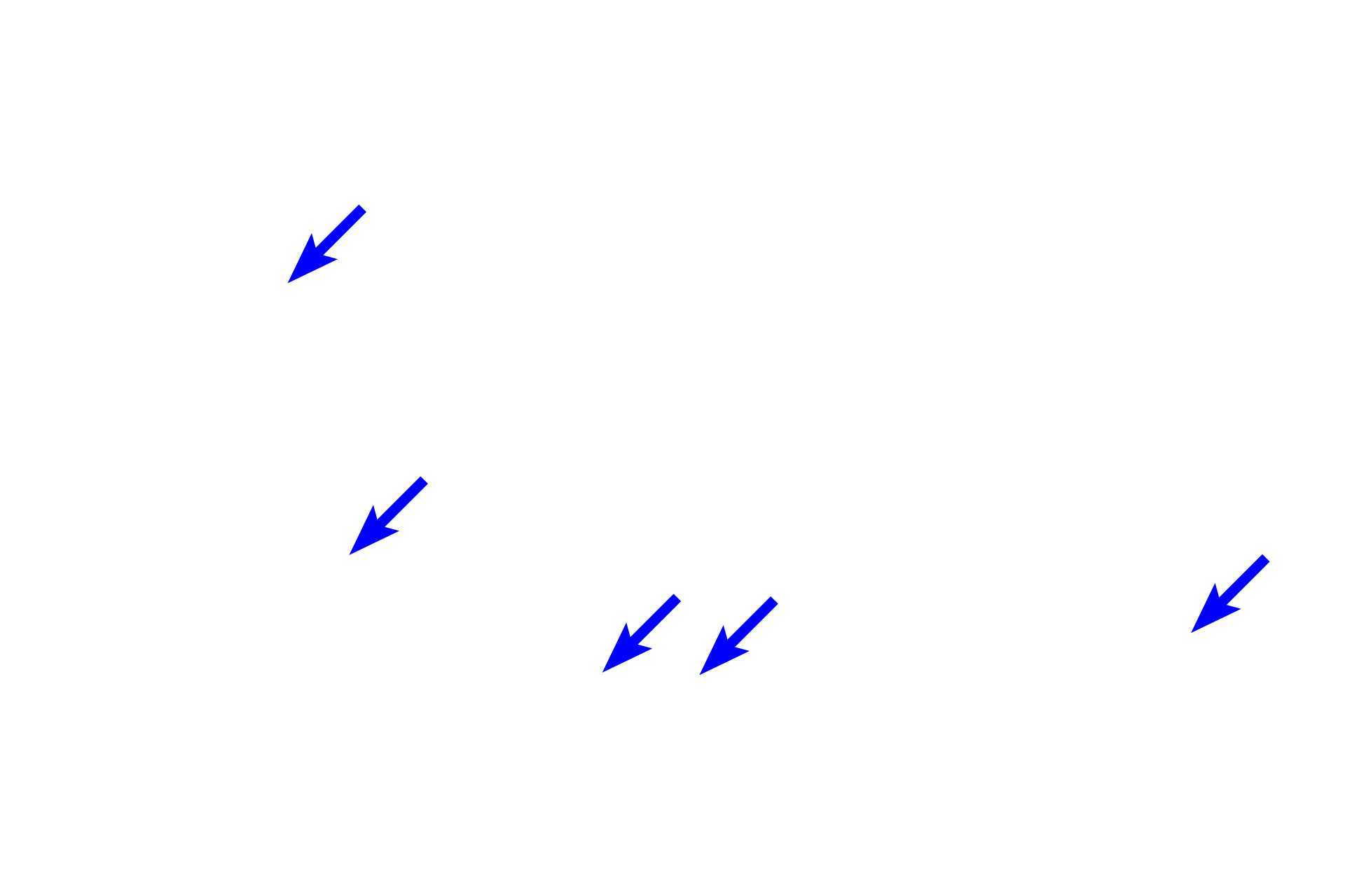 Muscle fibers <p>Cardiac muscle fibers comprise the myocardium of the heart and extends into the attachments of the large veins. Cardiac muscle tissue, seen here in cross section, shows numerous fibers with centrally located nuclei and surrounding myofibrils. The presence of these myofibrils and the size of the muscle fiber distinguishes this muscle type from smooth muscle fibers which are smaller and lack myofibrils. 200x</p>
