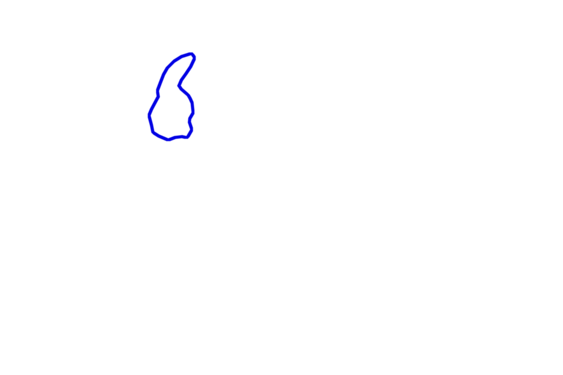 Unmyelinated axons <p>The dermis of the skin contains many peripheral nerves which convey both myelinated and unmyelinated axons.  Nerve fascicles are clearly outlined by their perineurium.  Also visible in the connective tissue are blood vessels and accumulations of adipocytes.  400x</p>
