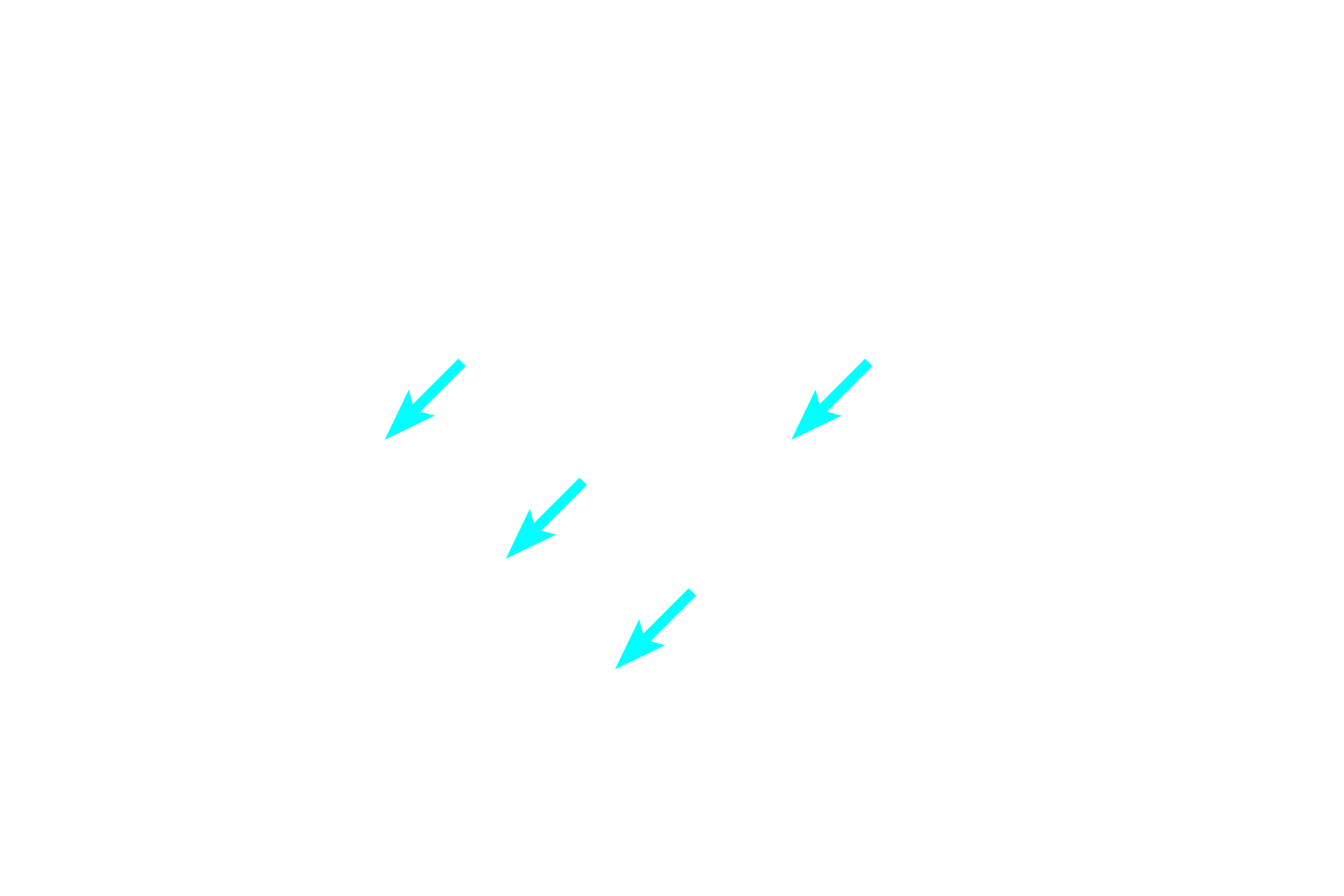 Endoneurium > <p>The endoneurium, stained green with this procedure, surrounds individual axons and consists of loose connective tissue.</p>

