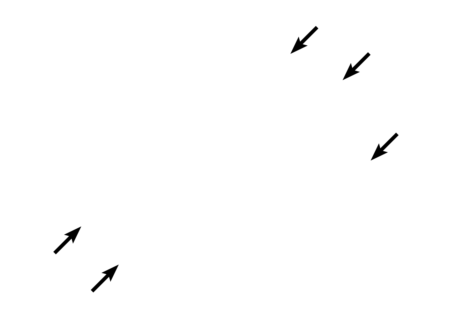 Perineurium <p>This cross section of a peripheral nerve is stained with the Masson stain to reveal its investing layers.  Individual axons and their sheaths are surrounded by an endoneurium.  Groups of axons form a fascicle enclosed by a perineurium.  This peripheral nerve, composed of a single fascicle, retains only a thin, fragmented rim of epineurium around its periphery.  400x</p>
