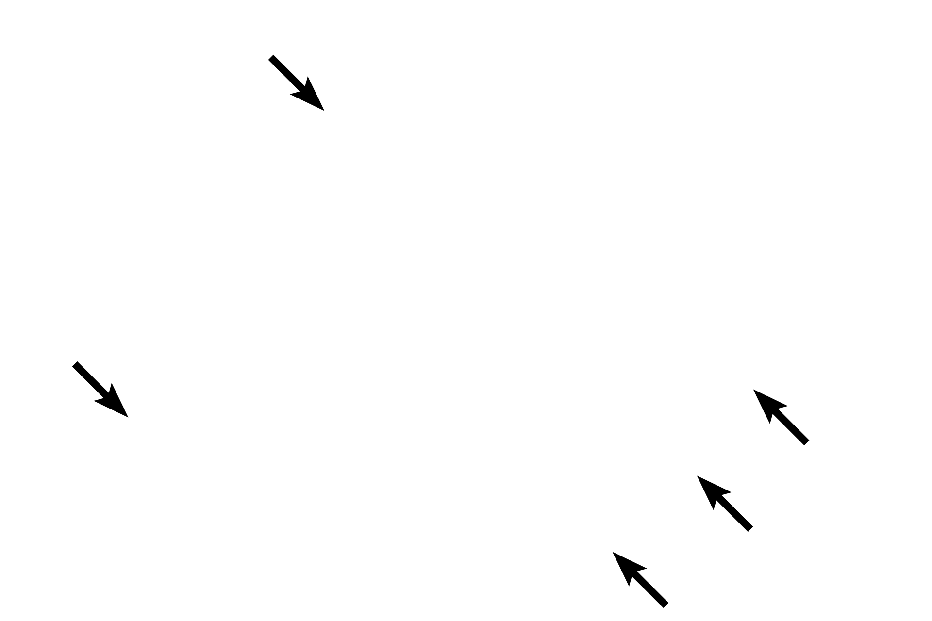 Epineurium <p>This cross section of a peripheral nerve is stained with the Masson stain to reveal its investing layers.  Individual axons and their sheaths are surrounded by an endoneurium.  Groups of axons form a fascicle enclosed by a perineurium.  This peripheral nerve, composed of a single fascicle, retains only a thin, fragmented rim of epineurium around its periphery.  400x</p>
