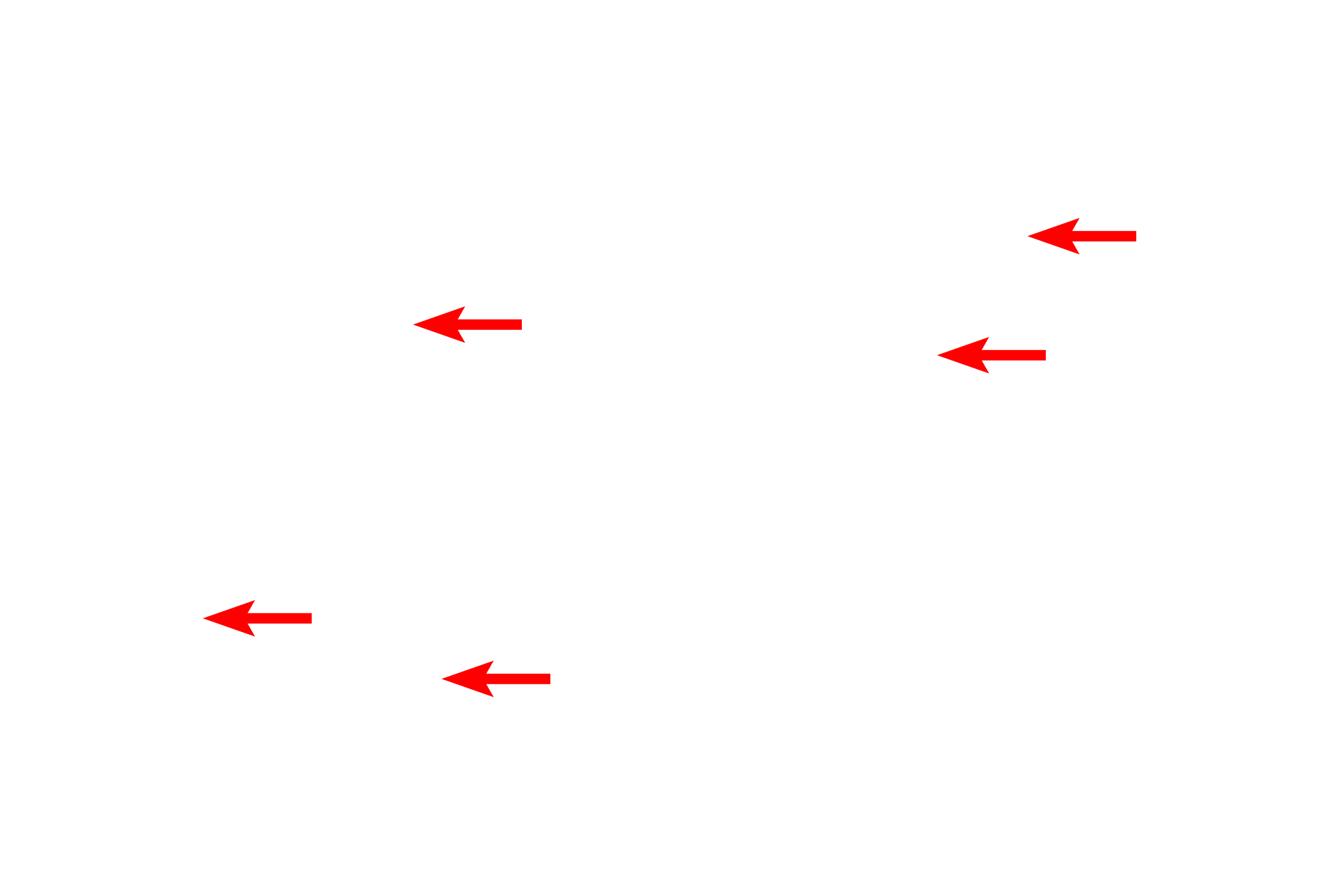 Myelinated axons <p>The myelin sheath in this section shows prominently because the tissue was fixed with osmium, retaining the lipid components of myelin.  Individual Schwann cells can either associate with a single axon, forming a myelin sheath, or can invest multiple axons, which are then referred to as unmyelinated.  Toluidine blue stain,  1000x</p>
