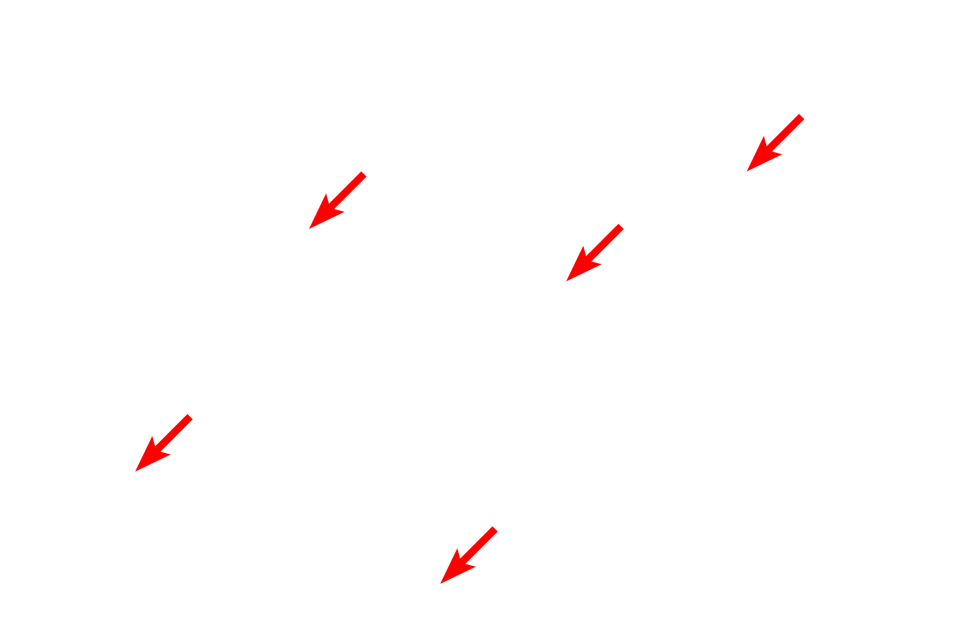 Myelin sheaths <p>The myelin sheath in this section shows prominently because the tissue was fixed with osmium, retaining the lipid components of myelin.  Individual Schwann cells can either associate with a single axon, forming a myelin sheath, or can invest multiple axons, which are then referred to as unmyelinated.  Toluidine blue stain,  1000x</p>
