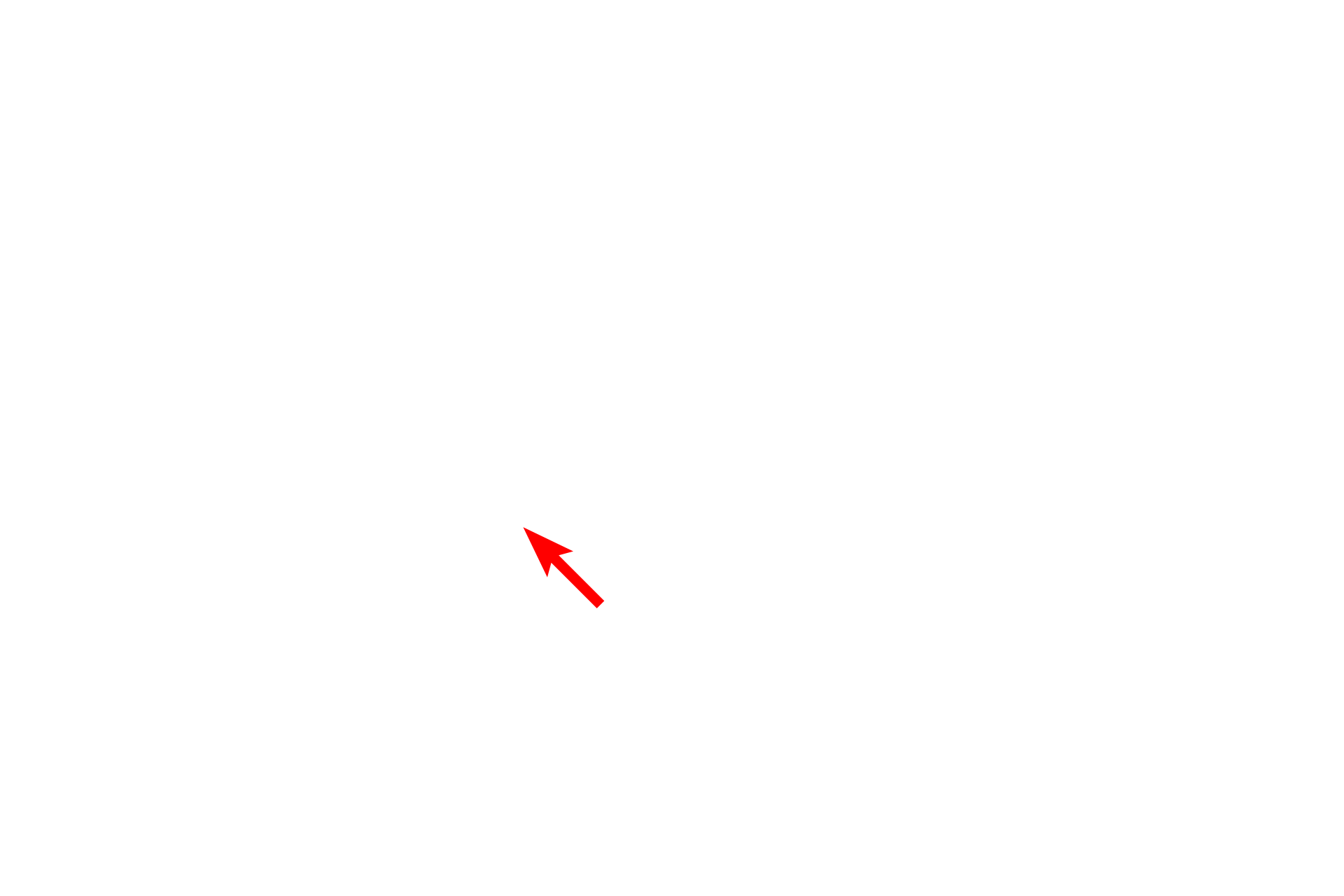 Fibroblast <p>The Schwann cell nuclei are seen in association with individual myelinated axons (red arrows), as well as clusters of unmyelinated axons (green arrows).  Each myelin-forming Schwann cell forms a single internode of myelin around one axon, whereas one non-myelinating Schwann cell envelopes multiple, small-caliber axons.  Each Schwann cell also secretes its own external lamina.</p>
