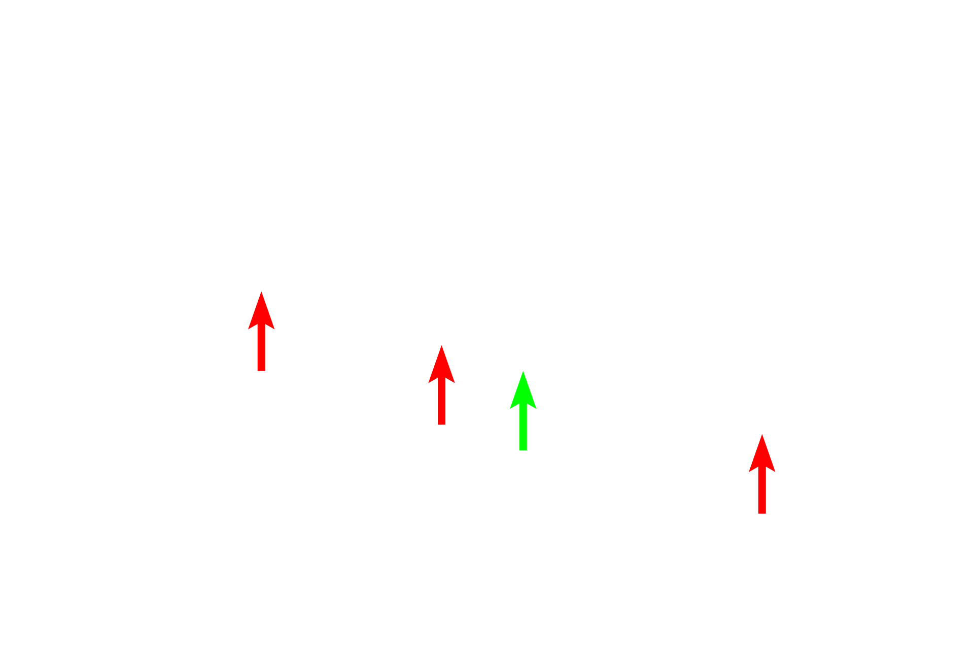 Microtubules > <p>Large number of microtubules (red arrows) in the axon condense as they pass through the node.  The apparent thinness (green arrow) of the axon in the node of Ranvier is the result of a tangential section through this region.</p>
