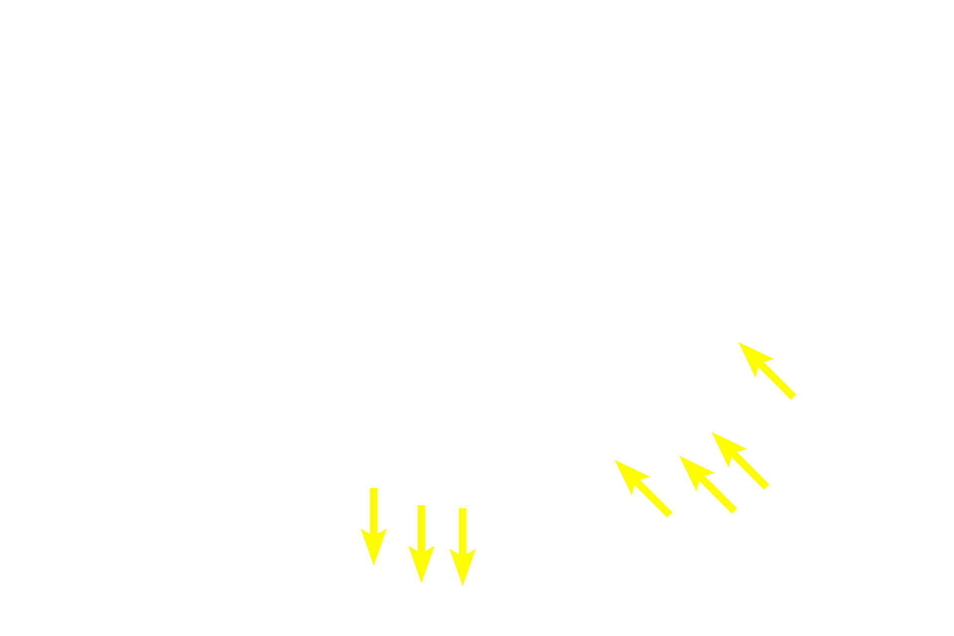 Schwann cell nuclei <p>Several pseudounipolar neurons are seen in this image.  Pseudounipolar neuron cell bodies vary in size, a feature that correlates with the type of sensory information each neuron conveys.  Each cell body is surrounded by satellite Schwann cells which form a capsule.  750x</p>
