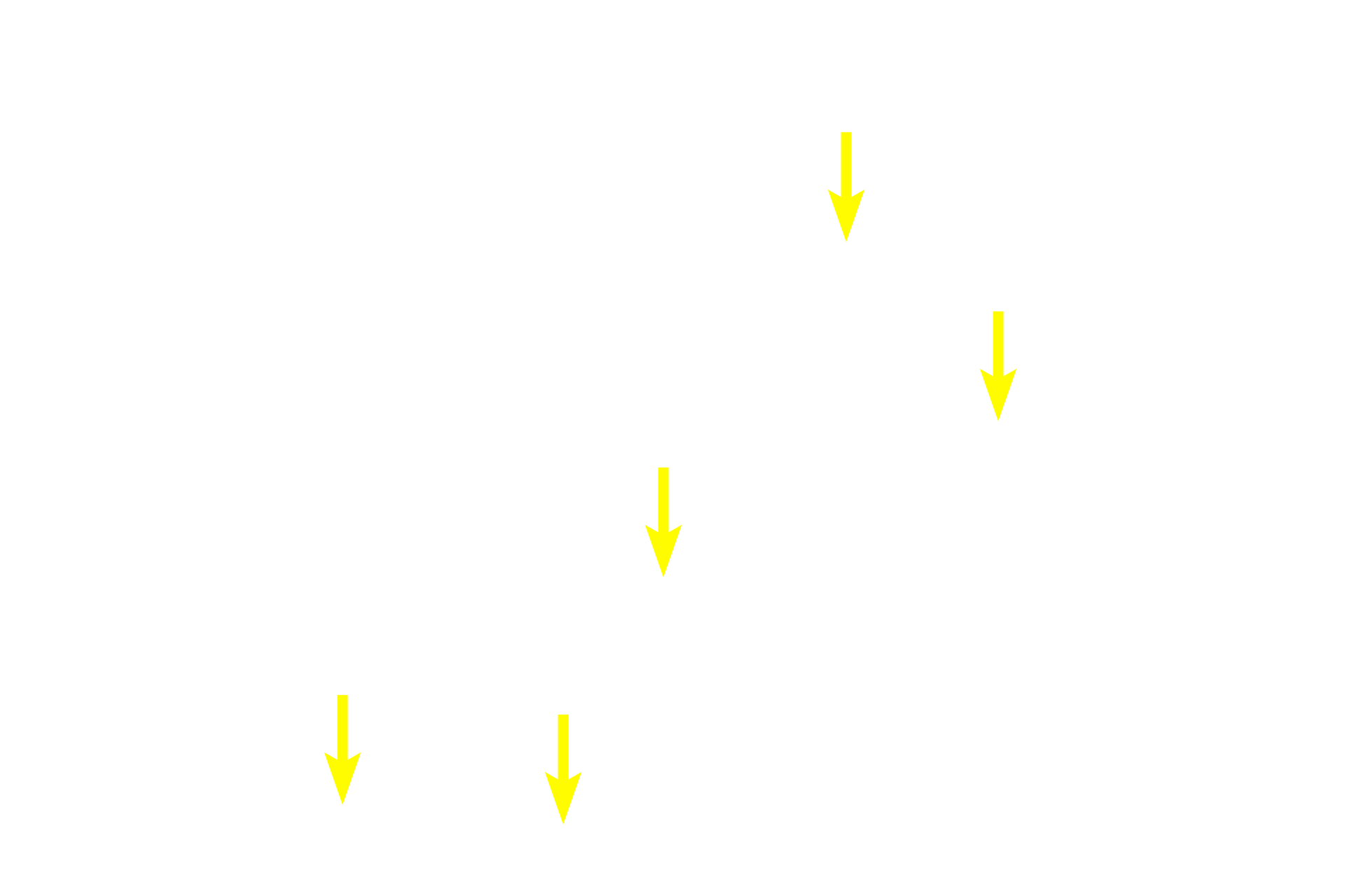 Capsule <p>Several pseudounipolar neurons are seen in this image.  Pseudounipolar neuron cell bodies vary in size, a feature that correlates with the type of sensory information each neuron conveys.  Each cell body is surrounded by satellite Schwann cells which form a capsule.  750x</p>
