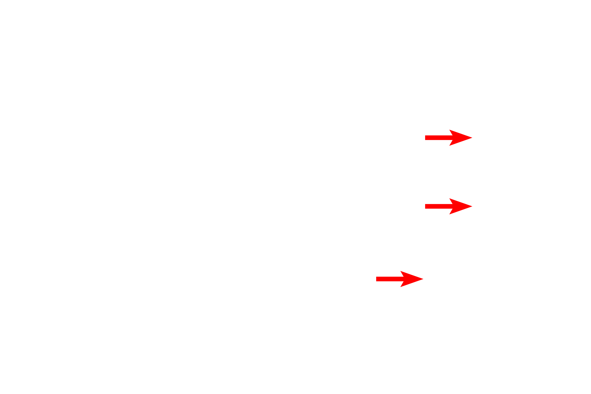Neuronal cell bodies <p>Bipolar neurons in the adult are found in organs of special sense, such as the cochlea of the inner ear, shown here.  A dendrite originates in the organ of Corti (receptor for hearing) and extends to the cell body of a bipolar neuron in the spiral ganglion.  From the opposite pole of that cell body, an axon emerges to form the cochlear division of cranial nerve VIII.  200x</p>
