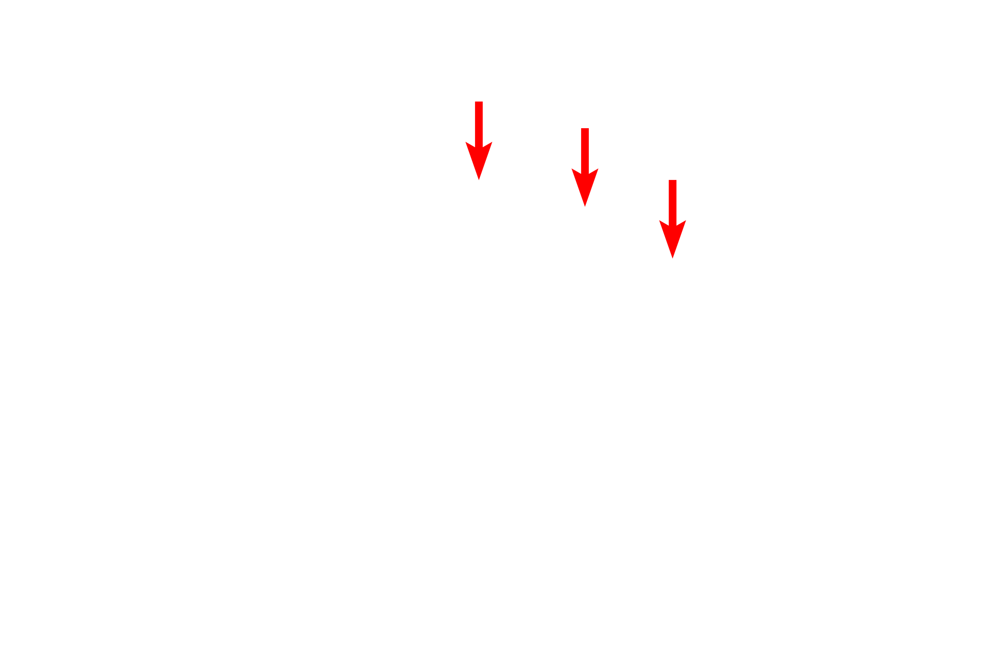 Dendrites <p>Bipolar neurons in the adult are found in organs of special sense, such as the cochlea of the inner ear, shown here.  A dendrite originates in the organ of Corti (receptor for hearing) and extends to the cell body of a bipolar neuron in the spiral ganglion.  From the opposite pole of that cell body, an axon emerges to form the cochlear division of cranial nerve VIII.  200x</p>
