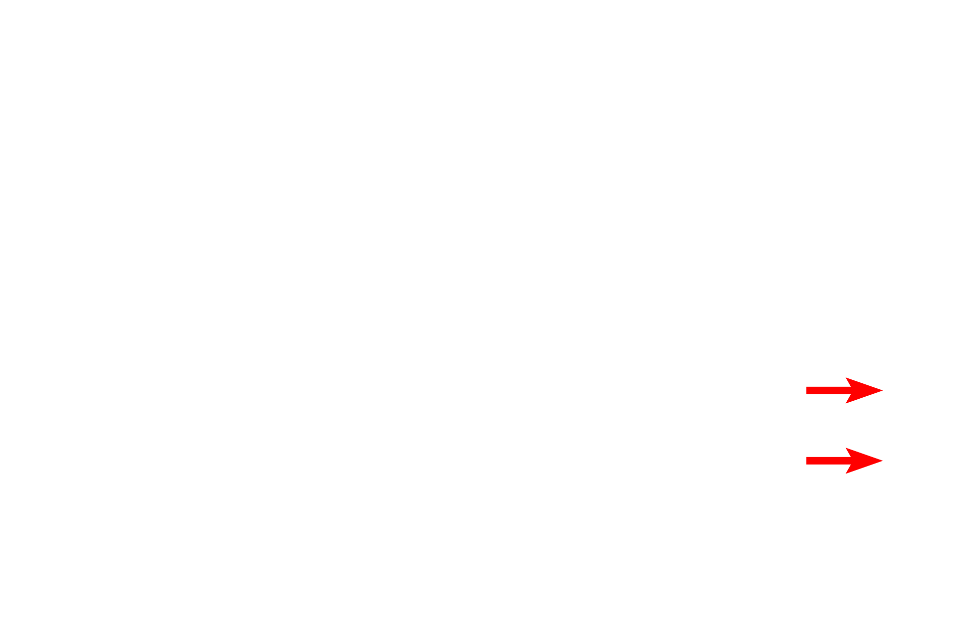 Axons <p>Bipolar neurons in the adult are found in organs of special sense, such as the cochlea of the inner ear, shown here.  A dendrite originates in the organ of Corti (receptor for hearing) and extends to the cell body of a bipolar neuron in the spiral ganglion.  From the opposite pole of that cell body, an axon emerges to form the cochlear division of cranial nerve VIII.  200x</p>

