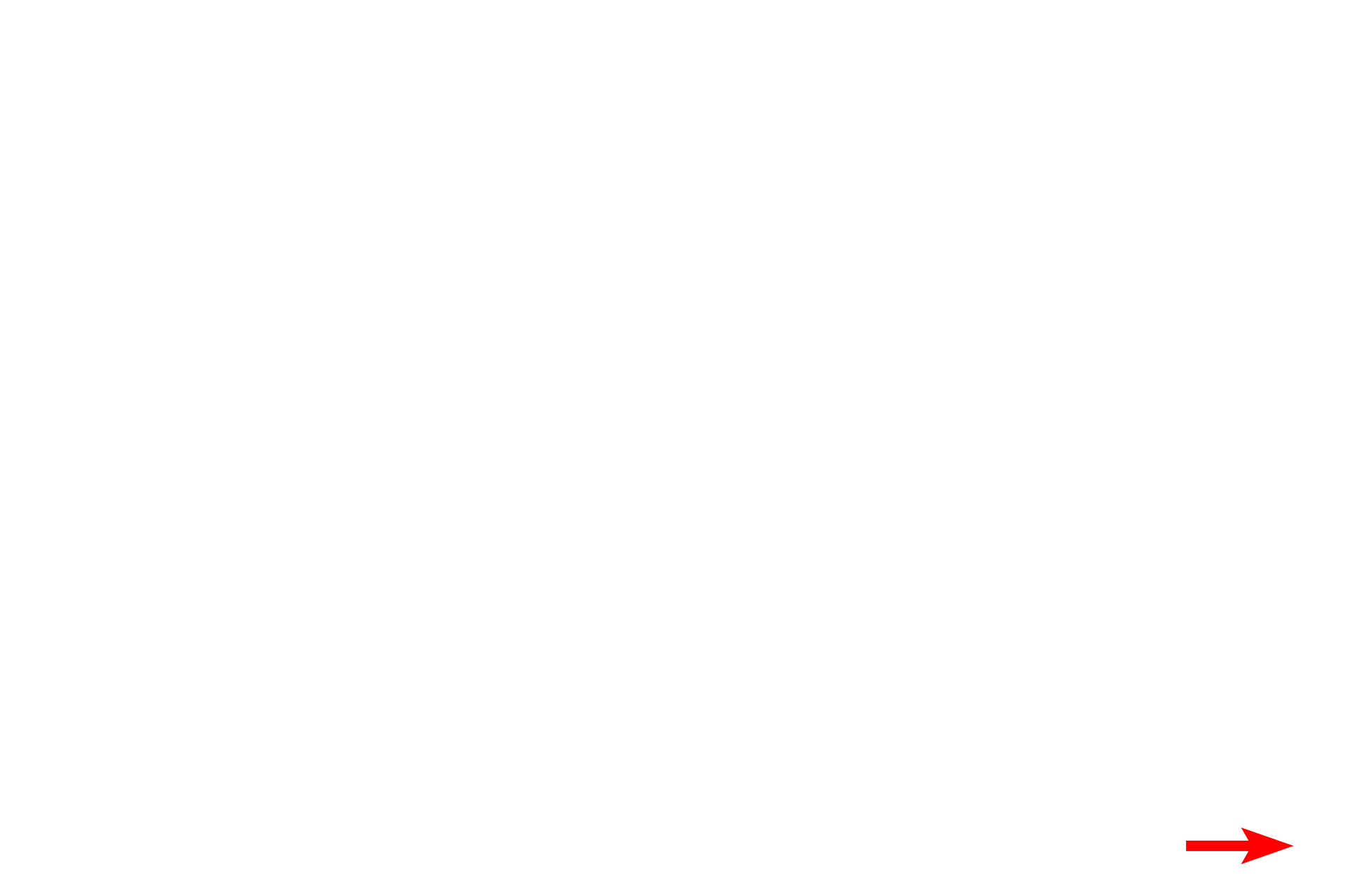 Cochlear branch of cranial nerve VIII <p>Bipolar neurons in the adult are found in organs of special sense, such as the cochlea of the inner ear, shown here.  A dendrite originates in the organ of Corti (receptor for hearing) and extends to the cell body of a bipolar neuron in the spiral ganglion.  From the opposite pole of that cell body, an axon emerges to form the cochlear division of cranial nerve VIII.  200x</p>
