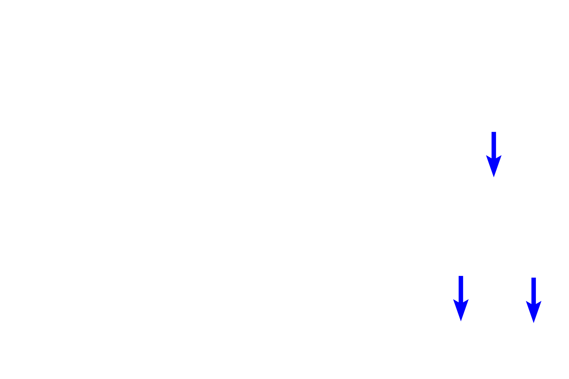 Axons <p>A dendrite originates in the organ of Corti and extends to a bipolar, neuronal cell body located in this spiral ganglion.  From the opposite pole of the cell body, an axon emerges which will join other axons to form the cochlear division of cranial nerve VIII.  Ensheathing Schwann cells can also be seen accompanying both processes.  400x</p>
