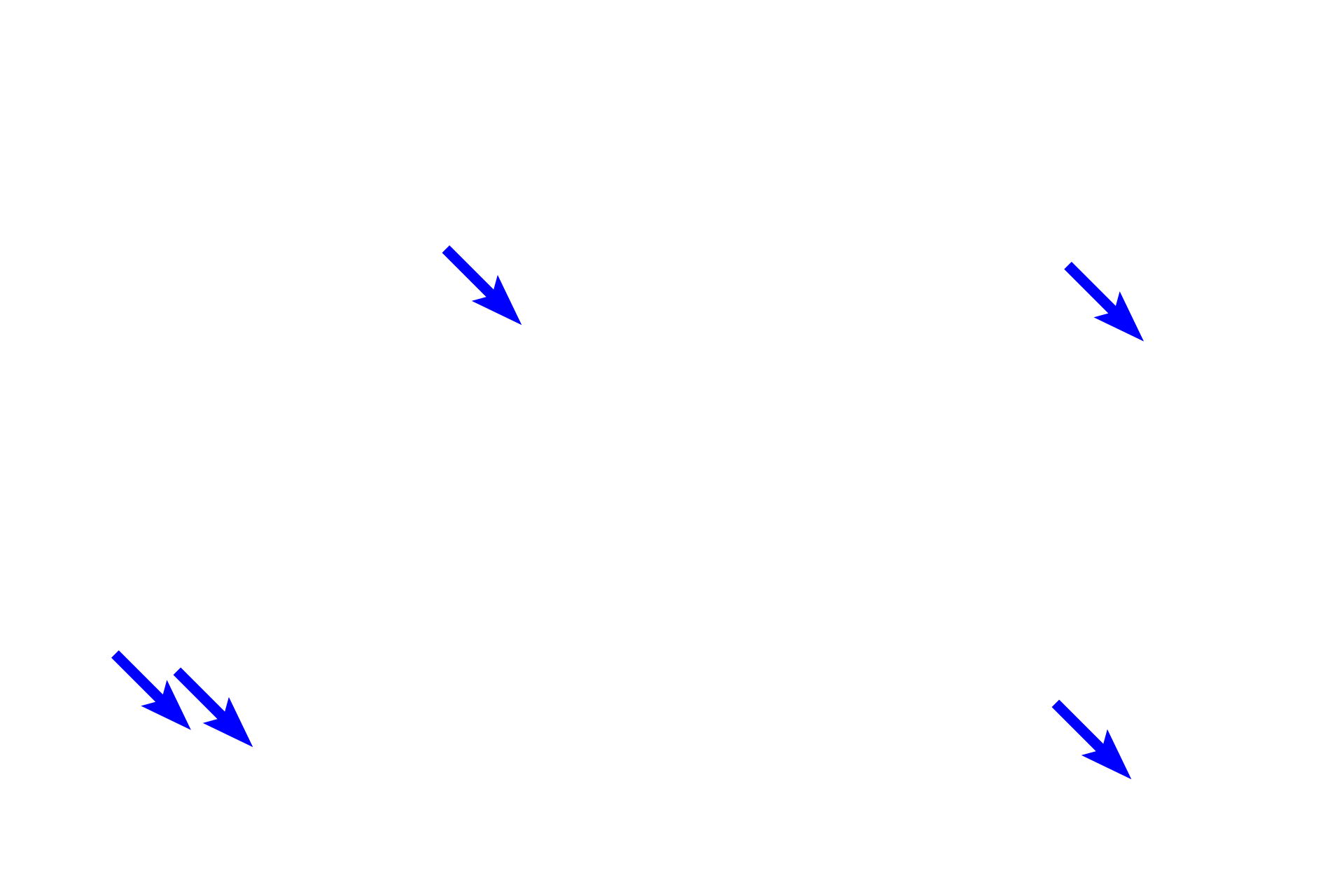 Schwann cells <p>A dendrite originates in the organ of Corti and extends to a bipolar, neuronal cell body located in this spiral ganglion.  From the opposite pole of the cell body, an axon emerges which will join other axons to form the cochlear division of cranial nerve VIII.  Ensheathing Schwann cells can also be seen accompanying both processes.  400x</p>
