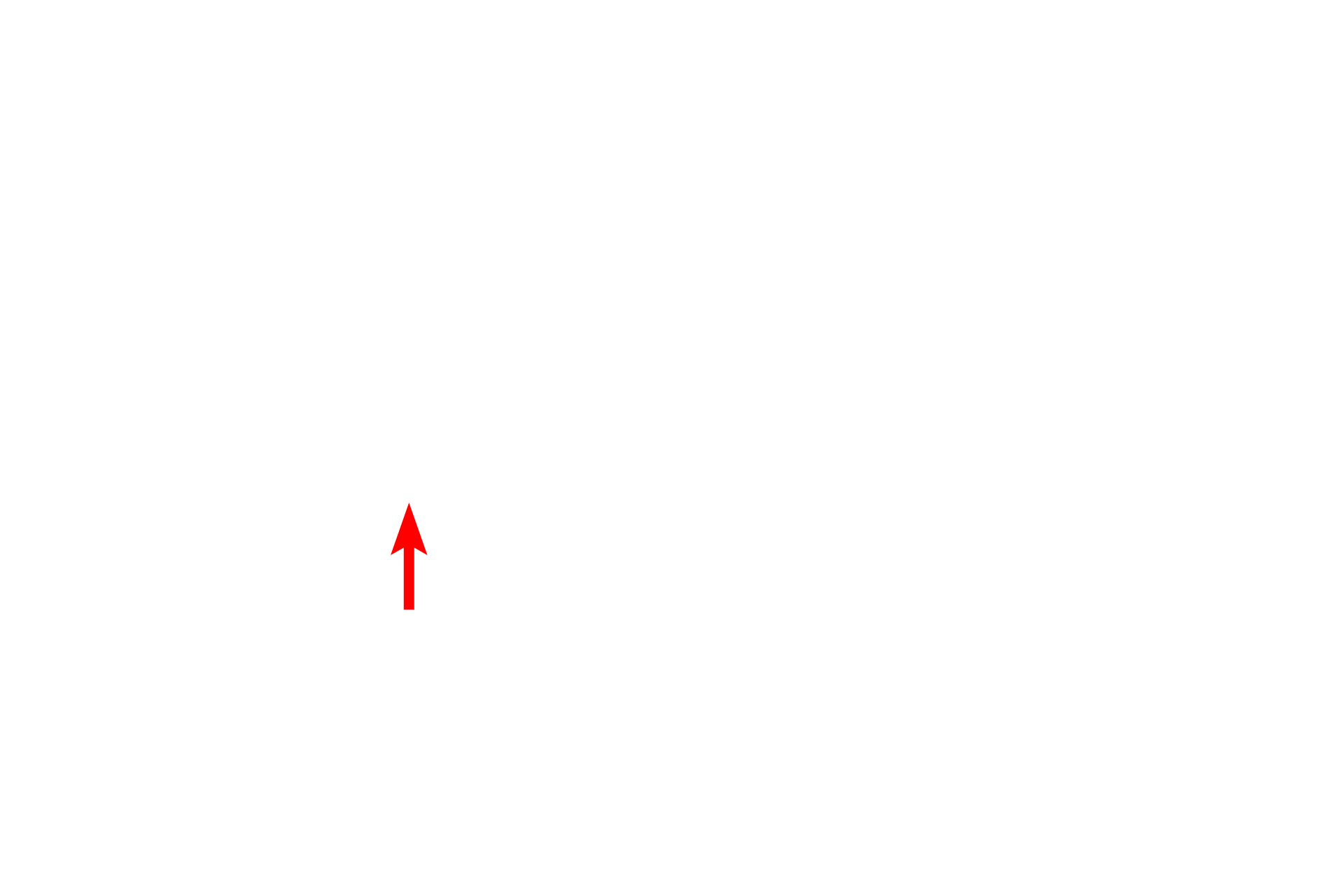  - Axon hillock > <p>The axon hillock is a specialized region of the cell body that lack basophilia and is the site of origin for the axon.</p>
