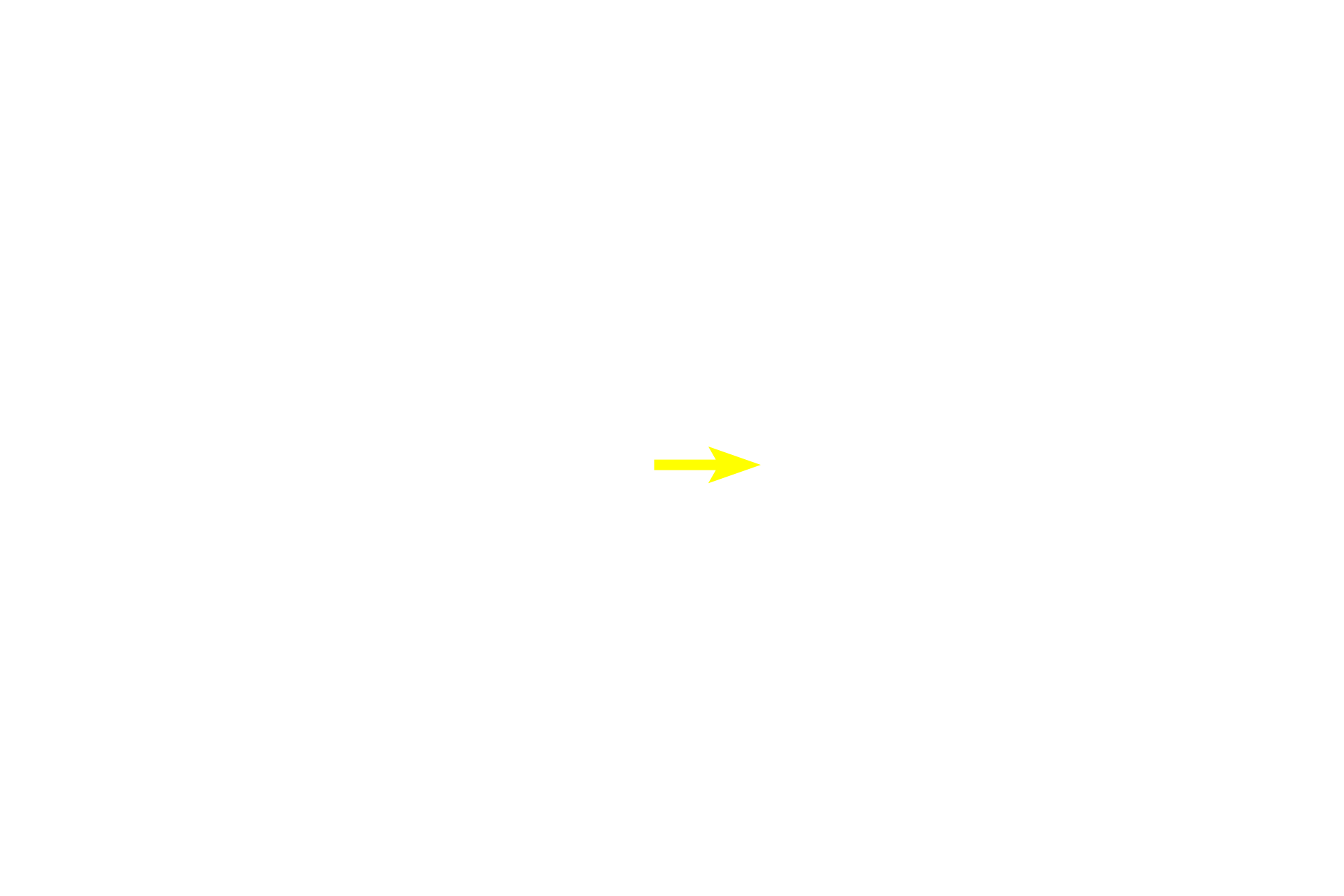 Nucleolus <p>The nucleus, nucleolus and Nissl substance (RER and polysomes) are located in the cell body of a neuron.  Also seen are two dendrites and an axon, the latter of which lacks RER.  The space around the cell body is a common artifact of nervous tissue.  Numerous glial cell nuclei are also present.  1000x</p>
