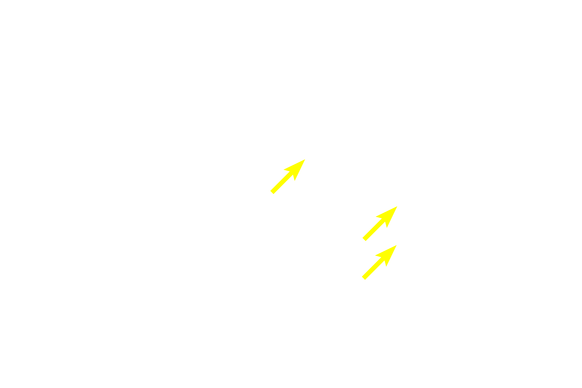 Nissl substance <p>The nucleus, nucleolus and Nissl substance (RER and polysomes) are located in the cell body of a neuron.  Also seen are two dendrites and an axon, the latter of which lacks RER.  The space around the cell body is a common artifact of nervous tissue.  Numerous glial cell nuclei are also present.  1000x</p>
