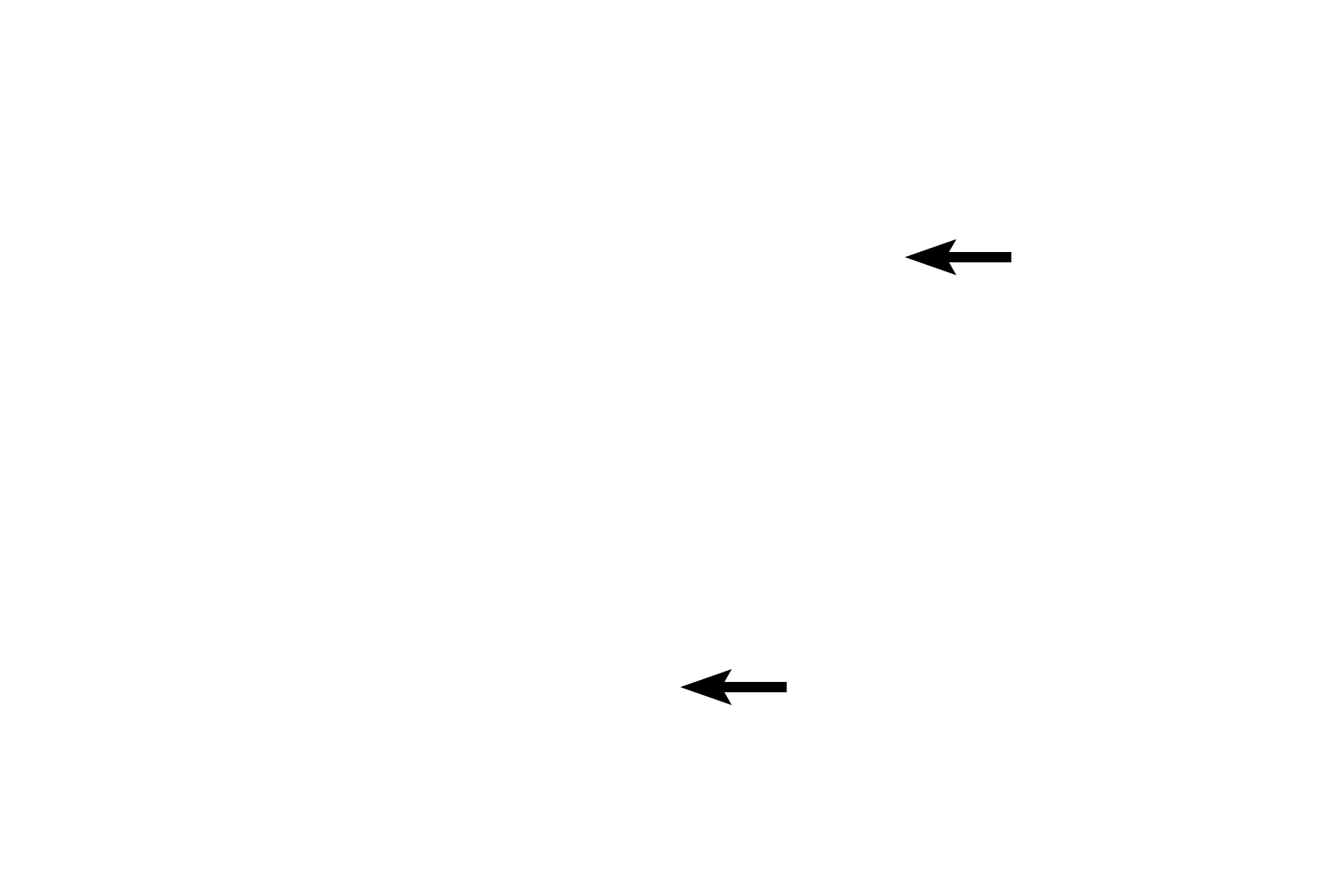 Dendrites <p>The nucleus, nucleolus and Nissl substance (RER and polysomes) are located in the cell body of a neuron.  Also seen are two dendrites and an axon, the latter of which lacks RER.  The space around the cell body is a common artifact of nervous tissue.  Numerous glial cell nuclei are also present.  1000x</p>
