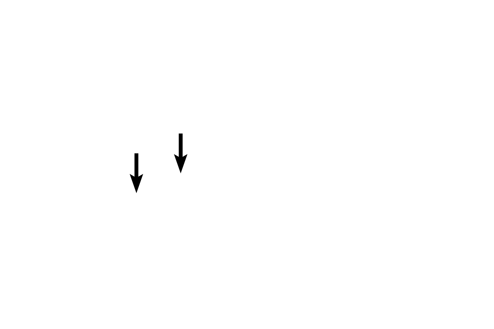 Axon <p>The nucleus, nucleolus and Nissl substance (RER and polysomes) are located in the cell body of a neuron.  Also seen are two dendrites and an axon, the latter of which lacks RER.  The space around the cell body is a common artifact of nervous tissue.  Numerous glial cell nuclei are also present.  1000x</p>
