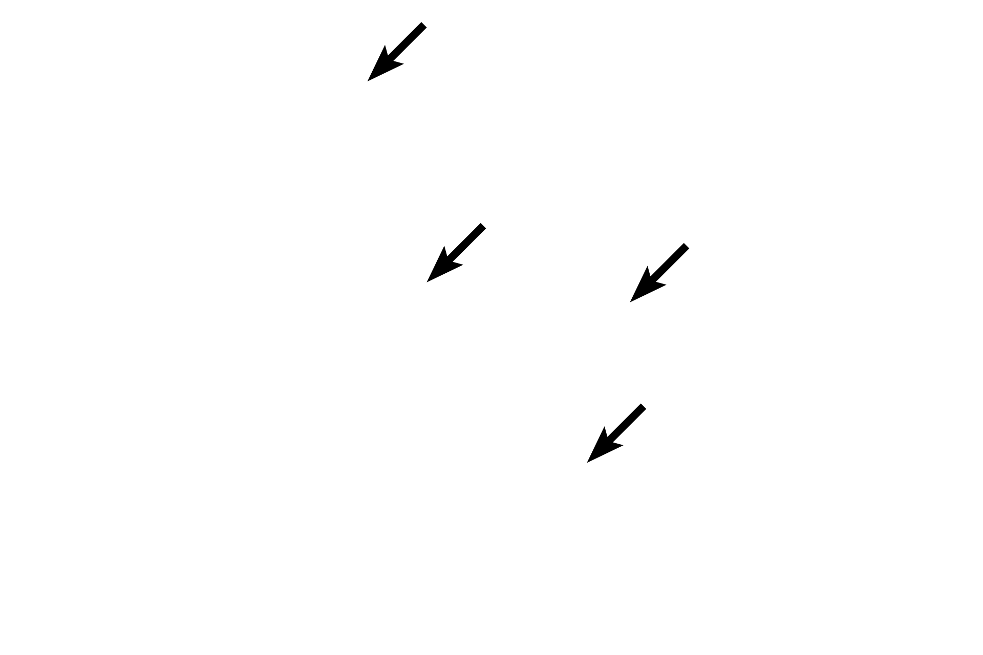 Blood vessels <p>The pars intermedia of the adenohypophysis lies adjacent to the pars nervosa and to the colloid-filled, cystic remnants of Rathke’s pouch.  Cells of this subdivision also migrate into the pars nervosa.  The pars intermedia, which is rudimentary in humans, is composed exclusively of basophils.  200x</p>
