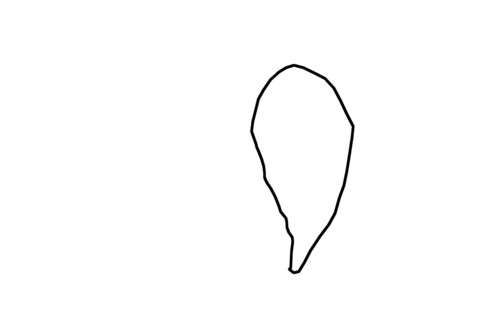  - Pars distalis <p>This low magnification of a monkey pituitary is cut midsagittally and stained with hematoxylin and eosin.  Note the distinct boundaries between the neurohypophyseal and adenohypophyseal tissues, indicating the different embryological origins of these subdivisions.  5x</p>
