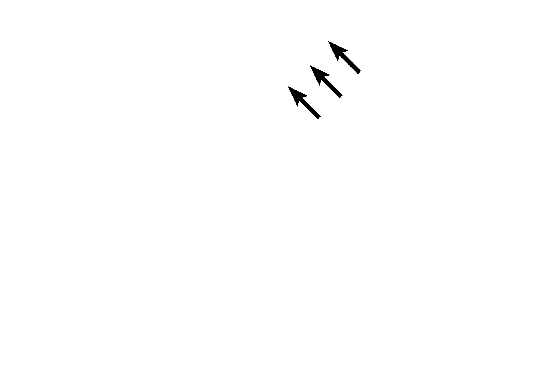  - Pars tuberalis <p>This low magnification of a monkey pituitary is cut midsagittally and stained with hematoxylin and eosin.  Note the distinct boundaries between the neurohypophyseal and adenohypophyseal tissues, indicating the different embryological origins of these subdivisions.  5x</p>
