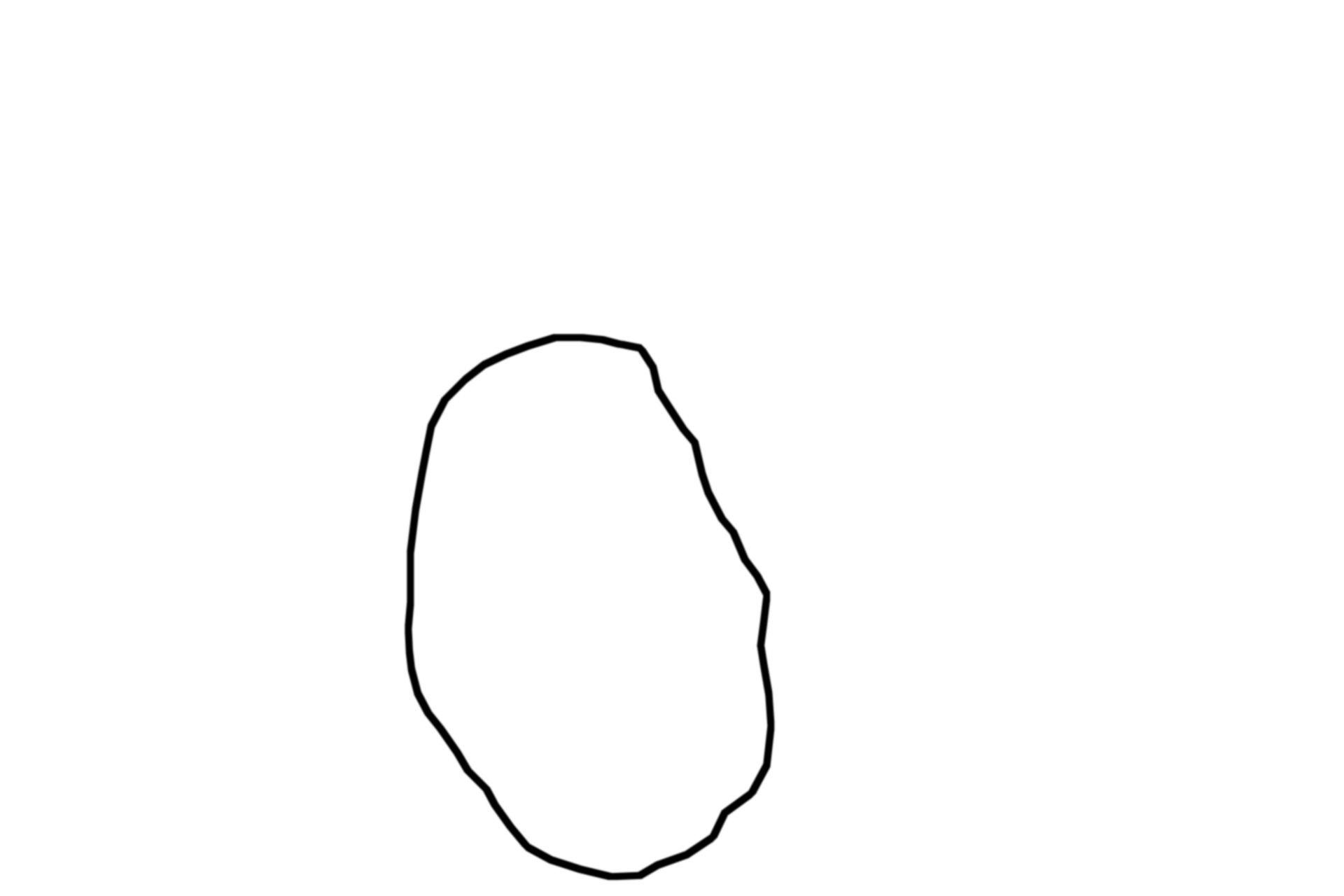  - Pars nervosa <p>This low magnification of a monkey pituitary is cut midsagittally and stained with hematoxylin and eosin.  Note the distinct boundaries between the neurohypophyseal and adenohypophyseal tissues, indicating the different embryological origins of these subdivisions.  5x</p>
