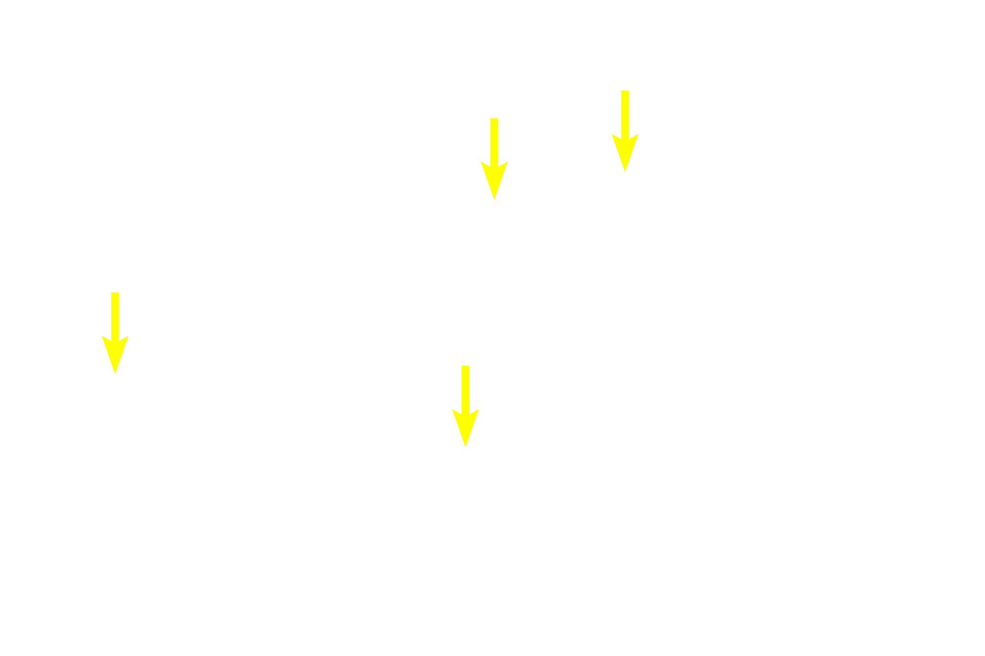Basophils <p>Hematoxylin and eosin staining of the pars distalis reveals two general types of secretory cells, basophils and acidophils.  Basophils contain purple-staining granules; acidophils contain pink-staining, eosinophilic granules.  Cells without obvious granules are called chromophobes and may be either degranulated chromophils or reserve cells.  All cells are arranged in plates or cords with numerous intervening fenestrated capillaries.  400x</p>
