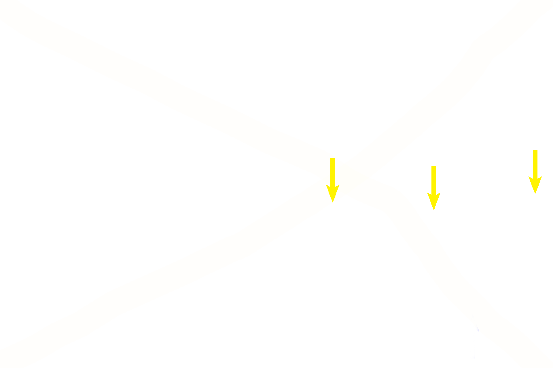 Elastic lamina <p>Bronchial arteries supply oxygenated blood to the walls of the respiratory passageways. Bronchial blood vessels can be seen in the secondary bronchus on the left and the trachea on the right. (The elastic lamina indicates that the passageway on the right is a trachea/primary bronchus.)  400x, 200x</p>
