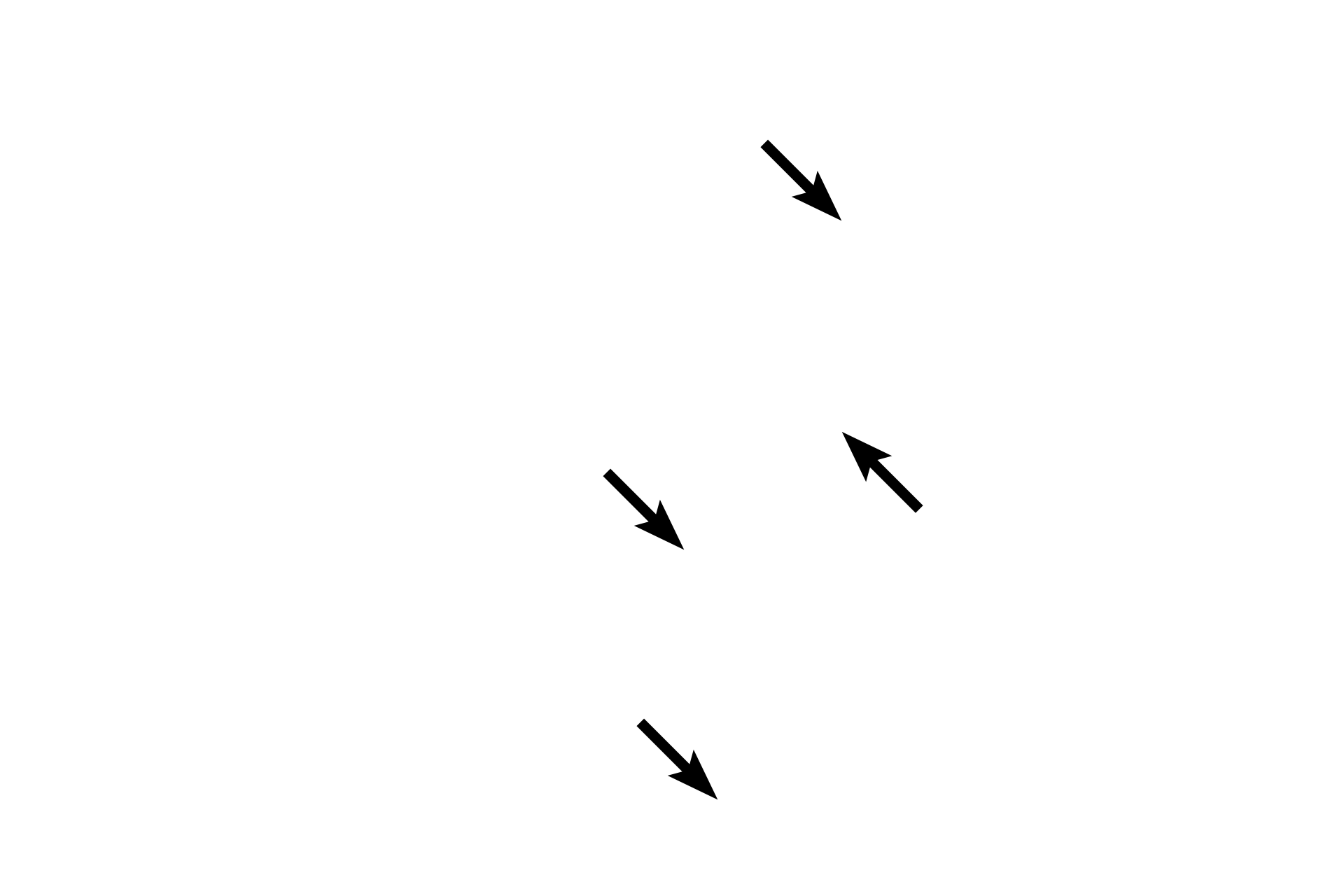 Schwann cell nuclei <p>The myelin sheath surrounds individual axons and consists of the spiral wrappings of Schwann cell plasma membranes. The uniquely high lipid content of myelin provides insulation of the axon and increases conduction velocity. The radial lines in the sheath are proteinaceous remnants of the plasma membrane. Axons and their sheaths are surrounded by the endoneurium.</p>
