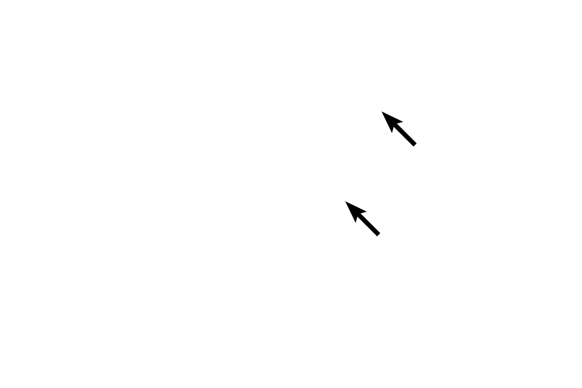 Schwann cell cytoplasm <p>The myelin sheath surrounds individual axons and consists of the spiral wrappings of Schwann cell plasma membranes. The uniquely high lipid content of myelin provides insulation of the axon and increases conduction velocity. The radial lines in the sheath are proteinaceous remnants of the plasma membrane. Axons and their sheaths are surrounded by the endoneurium.</p>
