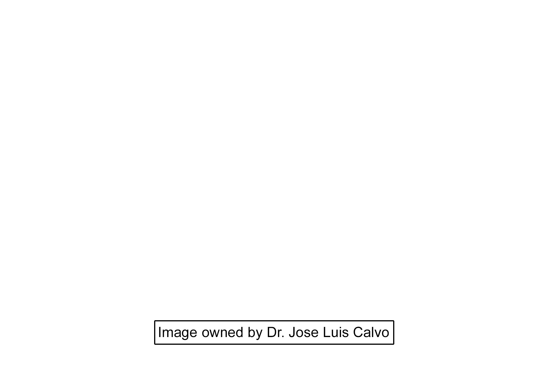 Image source >  <p>This image is owned by Dr. Jose Luis Calvo and is used under a royalty-free agreement.</p>

