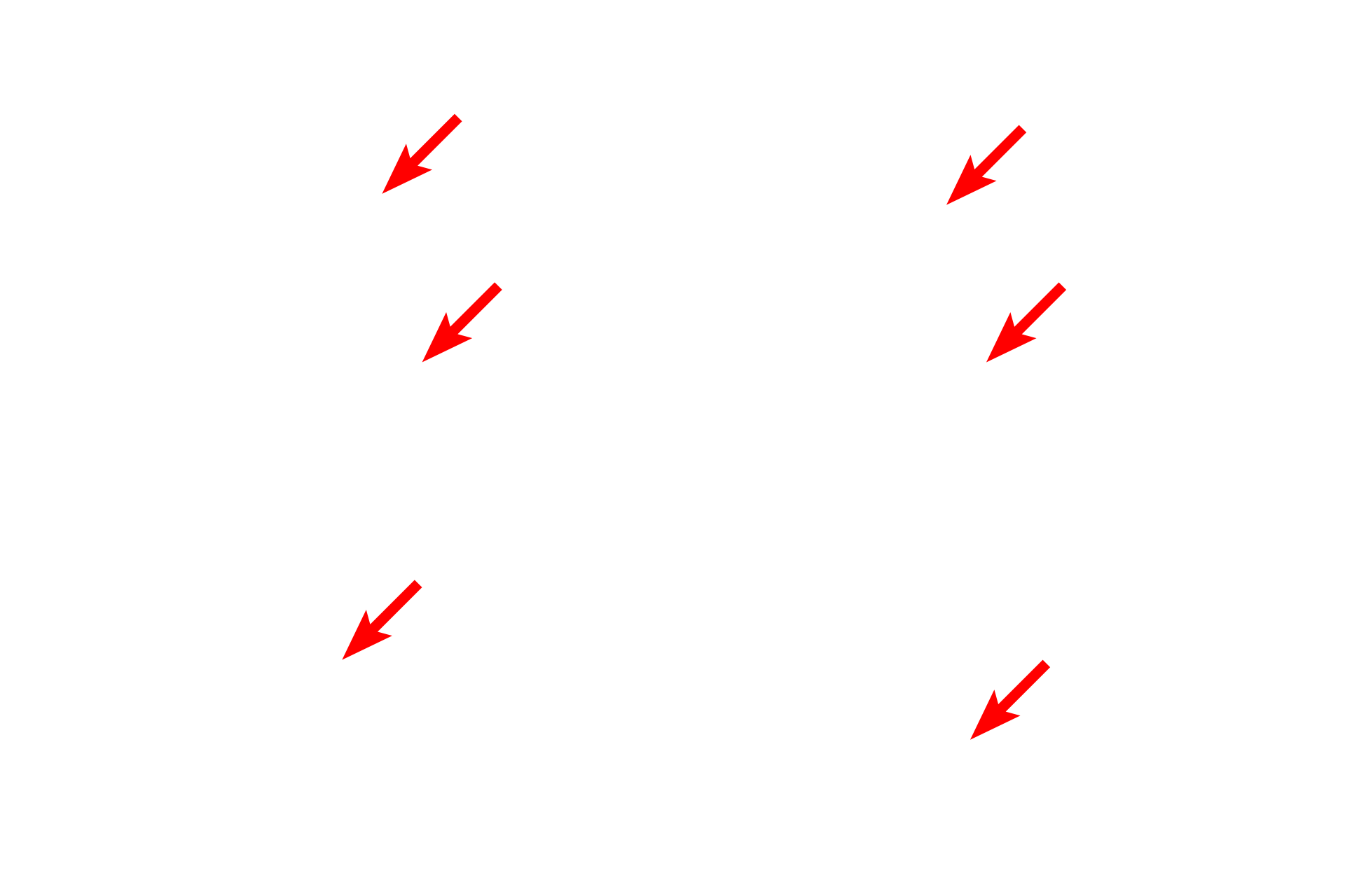 Myofibrils > <p>Myofibrils show the same banding pattern as that seen in skeletal muscle fibers, however they are not distinct in this micrograph. Visible here are sarcomeres, Z lines and M lines.</p>
