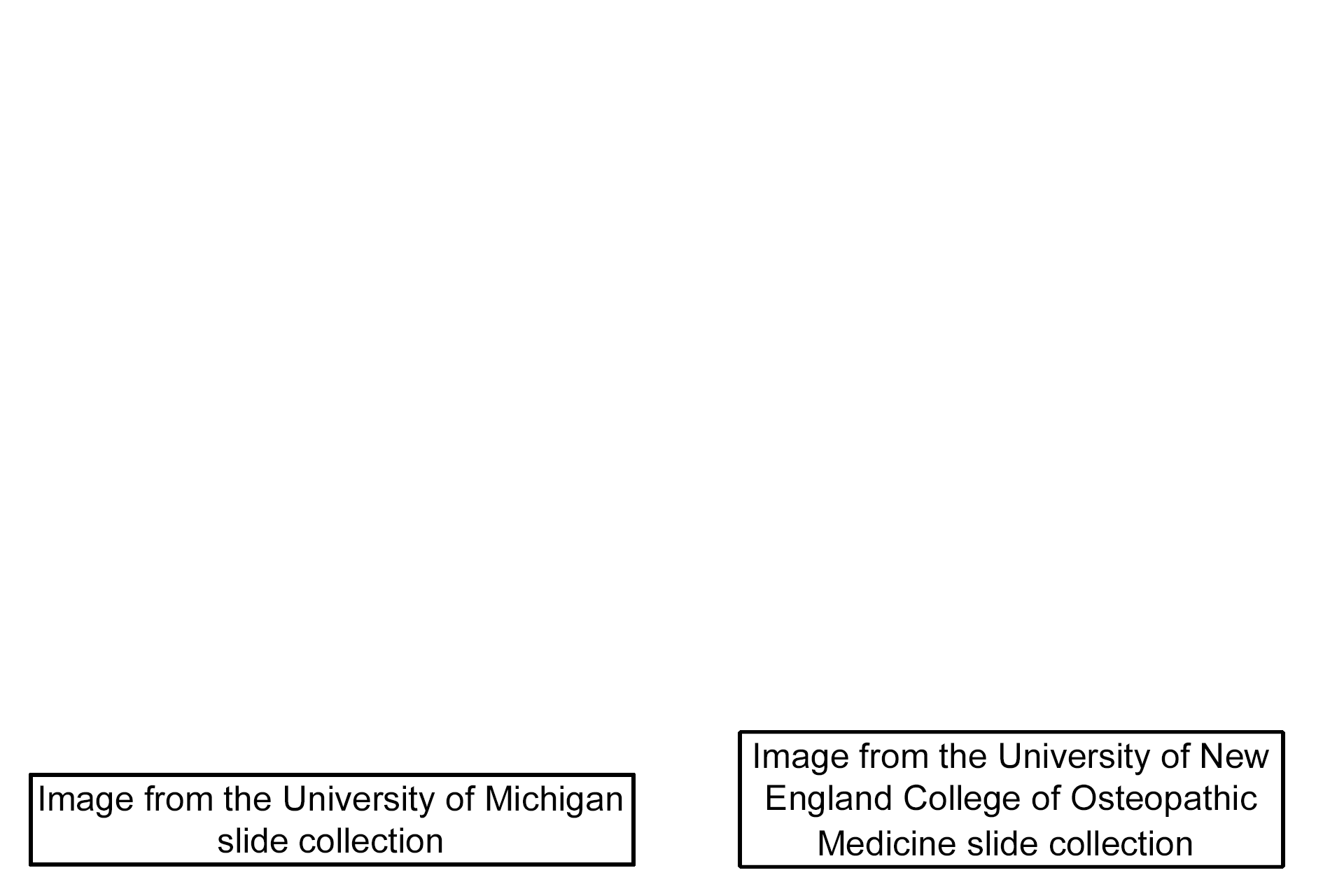Image source > <p>These images were was taken of slides from the University of Michigan and the University of New England College of Osteopathic Medicine slide collections.</p>
