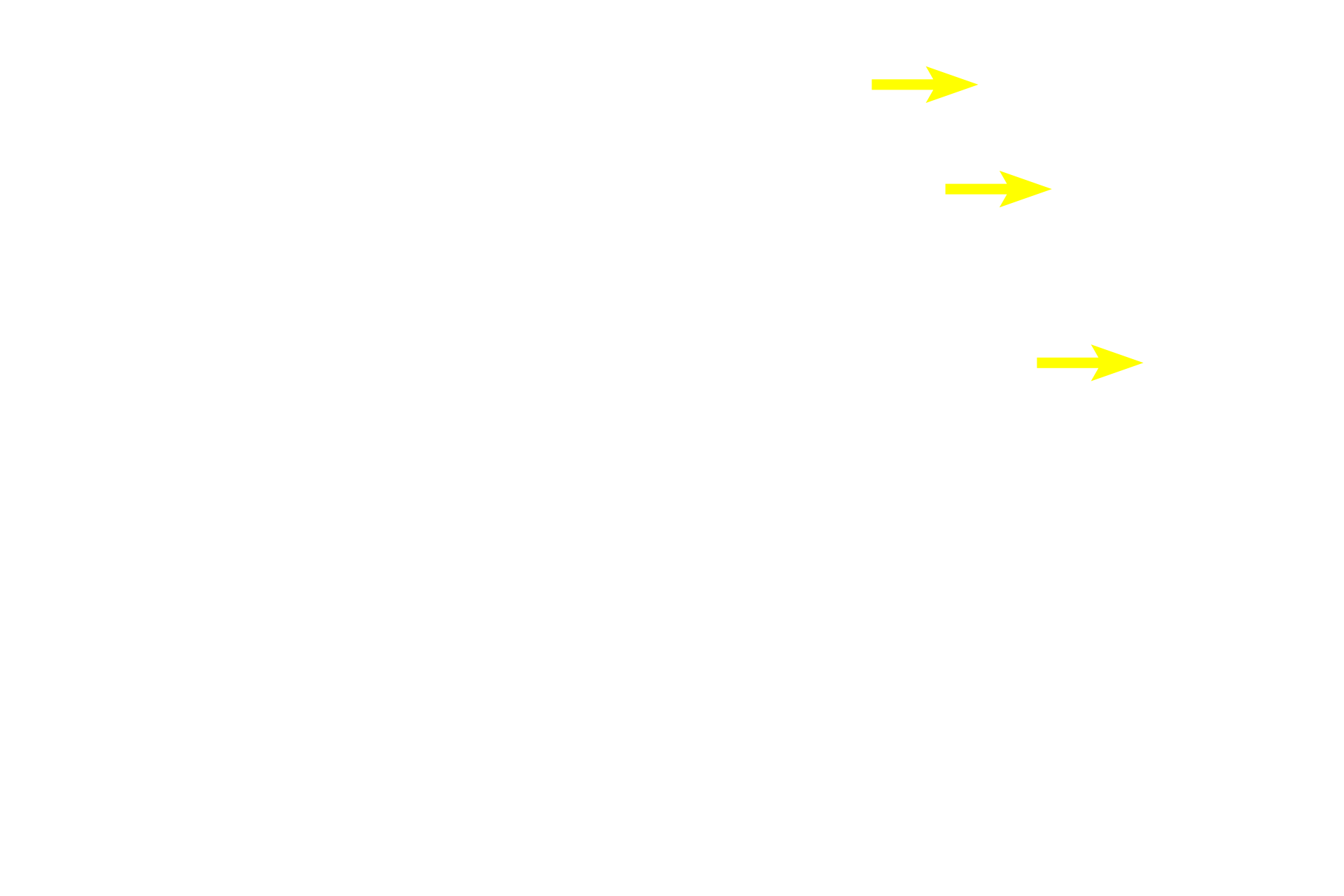  - Eccentric nuclei <p>These multipolar neurons are located in an autonomic ganglion in the sympathetic division of the autonomic nervous system.  Sympathetic ganglia are generally located at some distance from the organs they innervate and contain large numbers of both incoming preganglionic axons as well as exiting, efferent postganglionic axons from the multipolar neurons.  The neuron cell bodies are widely dispersed and extend numerous dendrites.  Eccentrically-located nuclei are common.  Satellite Schwann cells surround each neuronal in the ganglion.  Their cytoplasmic processes form a capsule around the cell body. 100x, 1000x</p>
