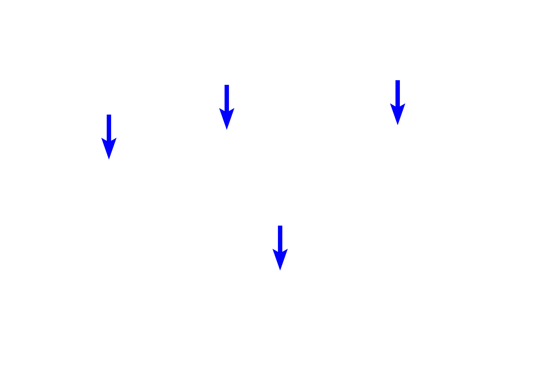 Pseudounipolar neurons <p>The unique shape of sensory, pseudounipolar neurons is demonstrated in this silver-stained section.  A single stem process emerges from the spherical cell body and eventually branches into central and peripheral axons.  This bifurcation is not visible here however the silver stain does reveal the twisted course of the stem process as it leaves the cell body.  This region is called the initial glomerulus of Cajal.  No dendrites originate from the cell body.  Silver stain, 600x</p>
