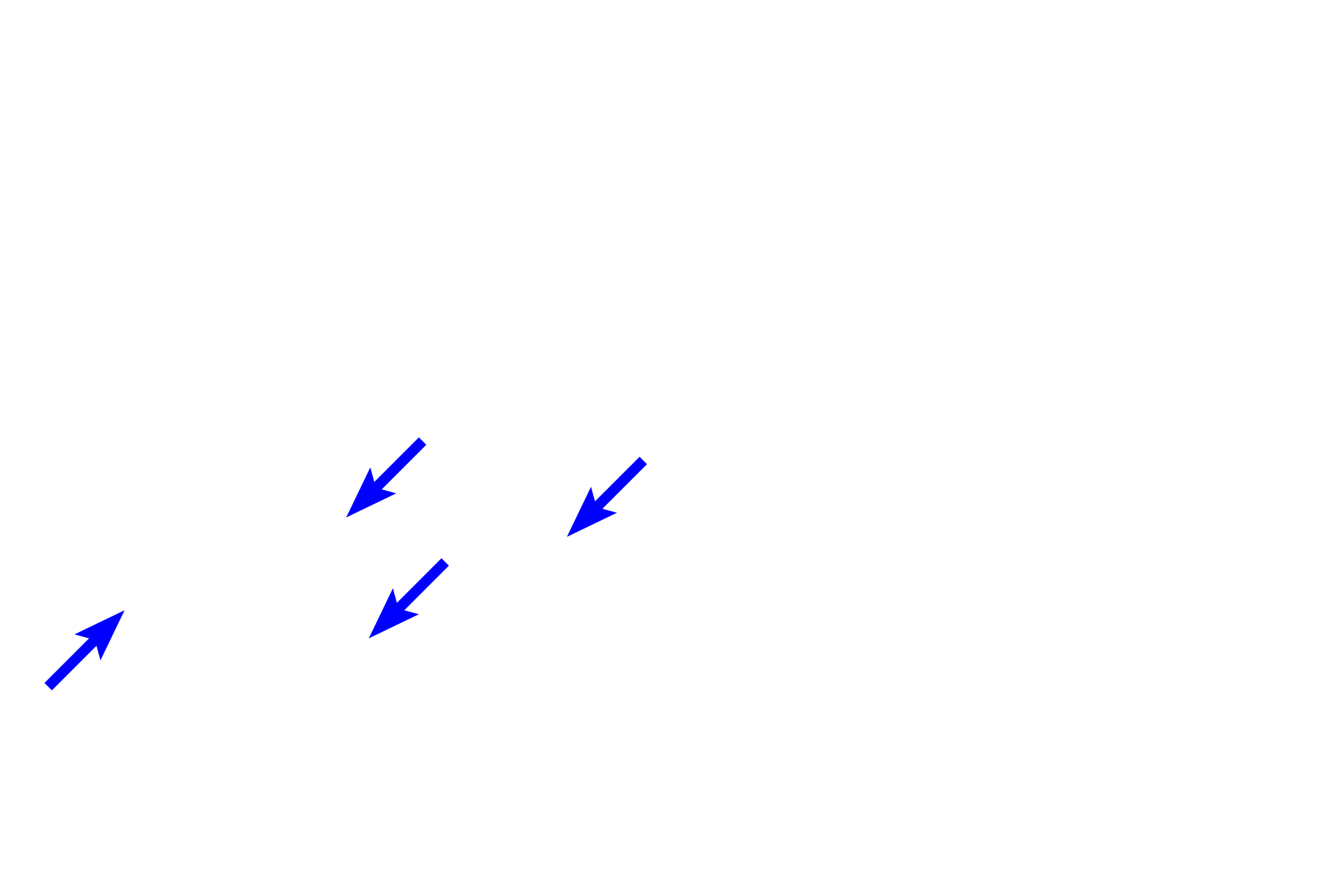 Emerging stem process <p>The unique shape of sensory, pseudounipolar neurons is demonstrated in this silver-stained section.  A single stem process emerges from the spherical cell body and eventually branches into central and peripheral axons.  This bifurcation is not visible here however the silver stain does reveal the twisted course of the stem process as it leaves the cell body.  This region is called the initial glomerulus of Cajal.  No dendrites originate from the cell body.  Silver stain, 600x</p>
