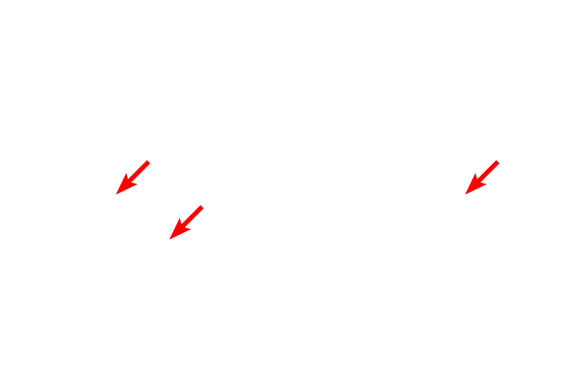 Pyramidal neurons <p>The shape of multipolar neurons can be highly variable and unique for specific regions of the brain.  Pyramidal neurons, seen here in the cerebral cortex, have pyramidal-shaped cell bodies and a thick apical dendrite.  Several lateral dendrites also extend from the base of the cell body, as does the axon.  Nuclei of glial cells (astrocytes and oligodendrocytes) are also visible. 400x</p>

