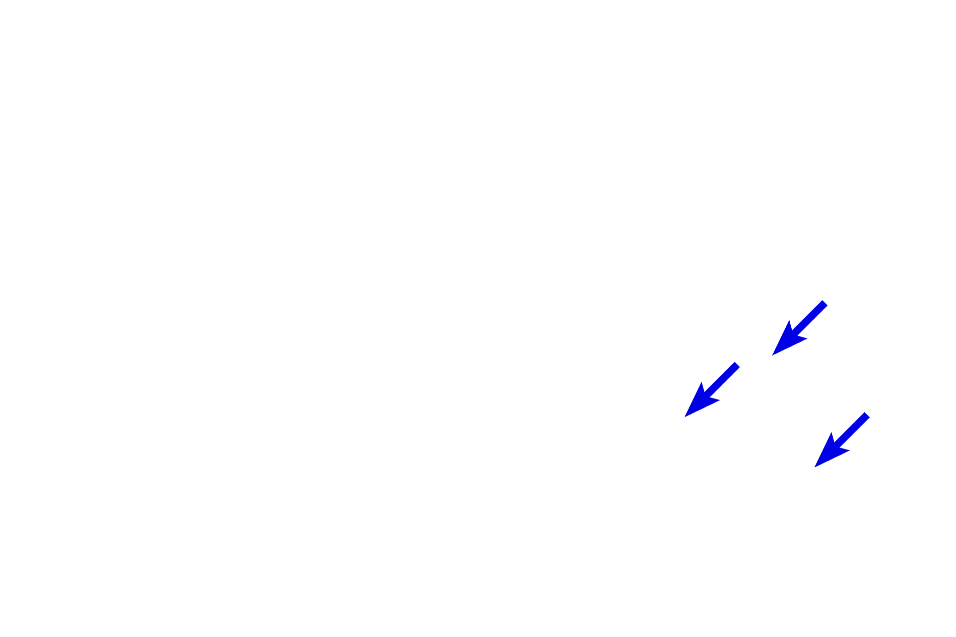 Endoneurium <p>The epineurium consists of dense irregular connective tissue that surrounds the nerve and contains adipocytes as well as blood vessels.  The perineurium, produced by perineurial cells, is a specialized, metabolically active connective tissue that contributes to the blood-nerve-barrier.  The endoneurium is a product of both fibroblasts and Schwann cells and surrounds individual myelinated axons as well as Schwann cells ensheathing unmyelinated axons.  </p>
