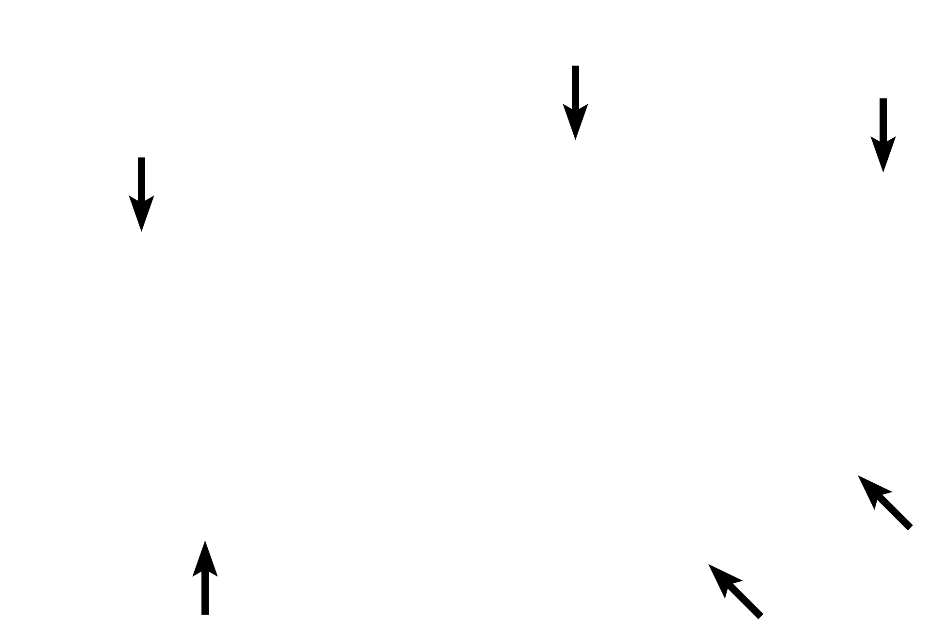 Capsule > <p>The entire pituitary is surrounded by a dense connective tissue capsule that is continuous with the dura mater.  Only a portion of the capsule is retained in this section.</p>
